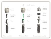 Implante Dental 3.2mm - Top Implants