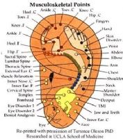 Balines Magnetizados con parche listos para usar (Envio Gratis)
